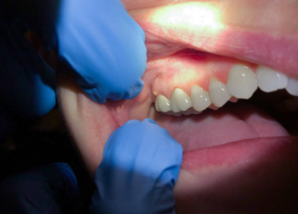 Best Urgent Care for Lost Fillings or Crowns in Elizabeth City, NC