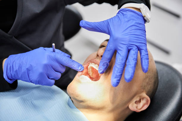 Best Emergency Gum Treatment in Elizabeth City, NC