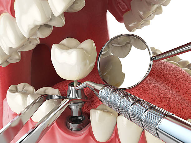 Best Emergency Treatment for Dental Infections or Abscesses in Elizabeth City, NC